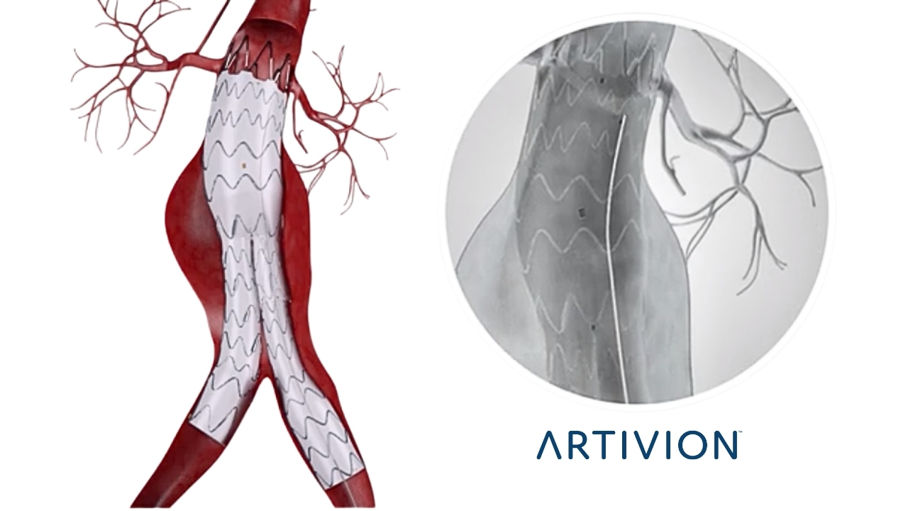 IMAGEM_ARTIVION